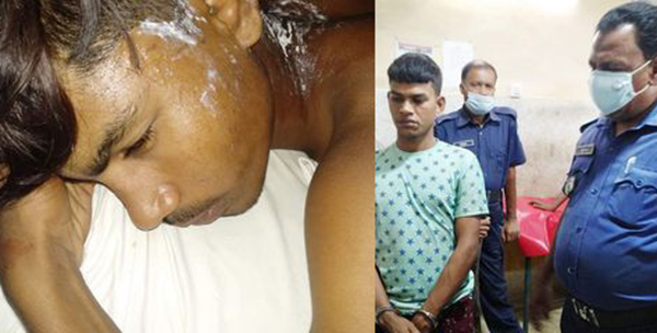 হোমনায় লুডু খেলায় বাজীর টাকা না দেওয়ায় এসিড নিক্ষেপ 
