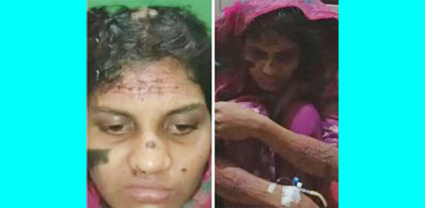 ব্রাহ্মণবাড়িয়ায় তুচ্ছ ঘটনার জেরে ৩ সন্তানের জননীকে হাত-পা বেঁধে ব্লেডের আঘাতে রক্তাক্ত জখম 