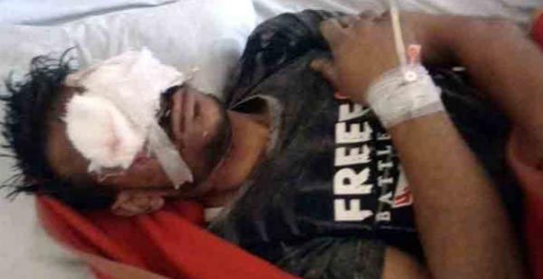 বাগেরহাটে এক সন্ত্রাসীর পা ভেঙ্গে দু’চোখ নষ্ট করে দিয়েছে অতিষ্ট এলাকাবাসী