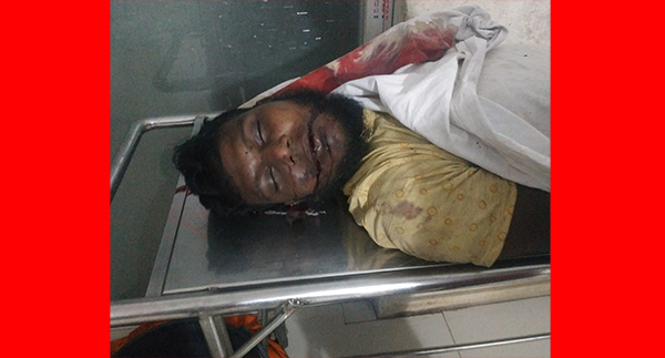 কোনাবাড়ীতে কাভার্ডভ্যান বিদ্যুতায়িত হয়ে হেল্পারের করুণ মৃত্যু : কর্তৃপক্ষের গাফিলতির অভিযোগ