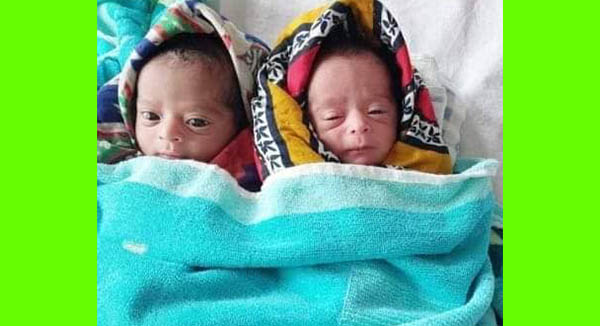 কুমিল্লায় এবার জমজ শিশুর জন্ম,নাম রাখা হলো পদ্মা-সেতু