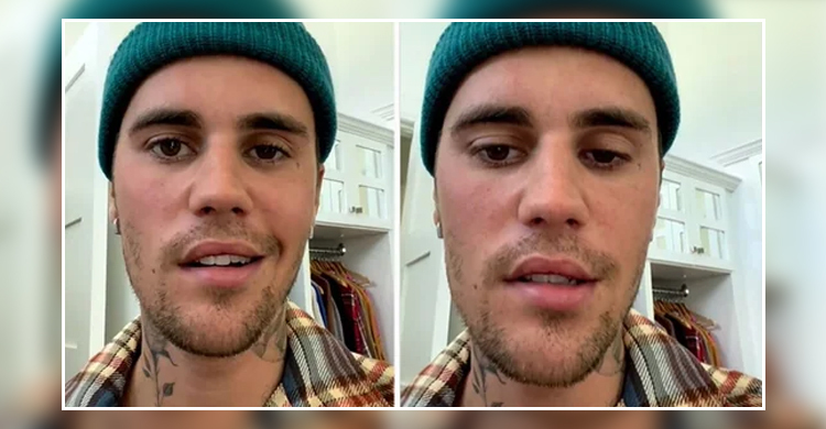 বিরল রোগে আক্রান্ত : জাস্টিন বিবার 