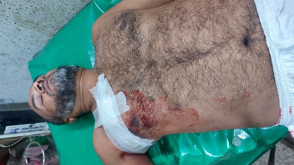 হোমনায় জামাইয়ের বিরুদ্ধে শ্বশুরকে হত্যাচেষ্টার অভিযোগ