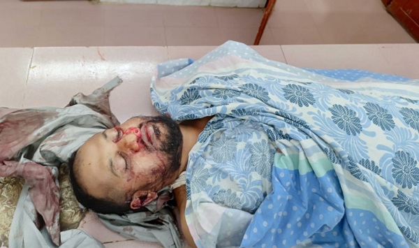 নোয়াখালীতে গাড়ির ধাক্কায় বিমান বাহিনীর সার্জেন্টের নিহত  
