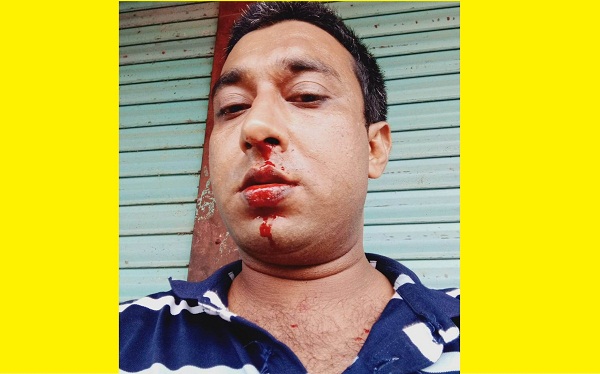 মীরসরাইয়ে সংবাদ প্রকাশের জেরে সাংবাদিকের উপর সন্ত্রাসী হামলা: আহত ৩