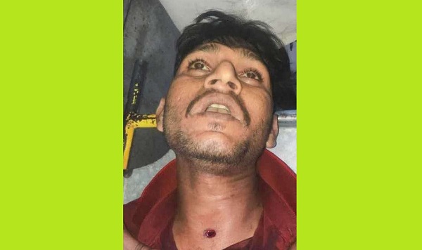  রূপগঞ্জে আধিপত্য বিস্তারে দুইপক্ষের সংঘর্ষে গুলিবিদ্ধ যুবক নিহত:আহত ২০
