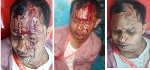 কালীগঞ্জে সাংবাদিক জাকারিয়া মামুনের ওপর সন্ত্রাসী হামলা