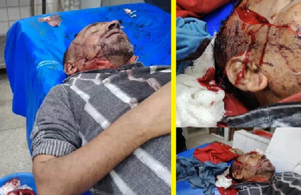 নরসিংদীতে জমি নিয়ে বিরোধের জেরে কামালের কান্ড: দেশীয় অস্ত্রের হামলায় গুরুতর আহত তপন মিয়া
